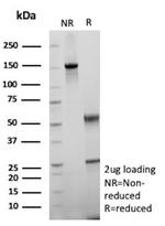 CD34 (Hematopoietic Stem Cell and Endothelial Marker) Antibody in SDS-PAGE (SDS-PAGE)