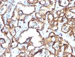 CD34 Monoclonal Antibody (HPCA1, 1171)