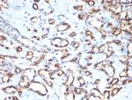 CD34 (Hematopoietic Stem Cell and Endothelial Marker) Monoclonal Antibody (SPM610)