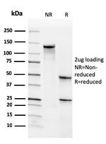 CD34 (Hematopoietic Stem Cell and Endothelial Marker) Antibody in SDS-PAGE (SDS-PAGE)
