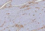 CD34 (Hematopoietic Stem Cell and Endothelial Marker) Antibody in Immunohistochemistry (Paraffin) (IHC (P))