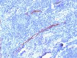 CD34 (Hematopoietic Stem Cell and Endothelial Marker) Recombinant Rabbit Monoclonal Antibody (HPCA1/1806R)