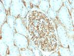 CD34 Recombinant Rabbit Monoclonal Antibody (HPCA1, 2598R)
