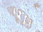 ATG5 Monoclonal Antibody (ATG5, 2101)