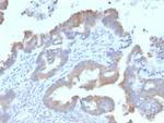 ATG5 Monoclonal Antibody (ATG5, 2492)