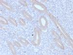 ATG5 Monoclonal Antibody (ATG5, 2553)
