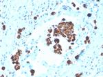 Napsin A (Lung Adenocarcinoma Marker) Monoclonal Antibody (NAPSA/3308), Biotin