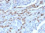 Napsin A (Lung Adenocarcinoma Marker) Antibody in Immunohistochemistry (Paraffin) (IHC (P))