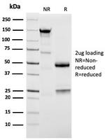 Napsin A (Lung Adenocarcinoma Marker) Antibody in SDS-PAGE (SDS-PAGE)