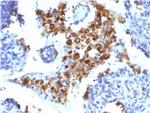 Napsin A (Lung Adenocarcinoma Marker) Monoclonal Antibody (NAPSA/1238)