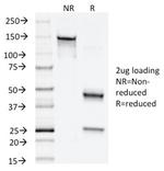 Napsin A (Lung Adenocarcinoma Marker) Antibody in SDS-PAGE (SDS-PAGE)