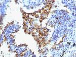 Napsin A (Lung Adenocarcinoma Marker) Antibody in Immunohistochemistry (Paraffin) (IHC (P))