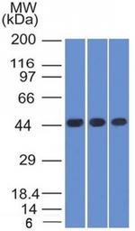 Napsin A (Lung Adenocarcinoma Marker) Antibody in Western Blot (WB)