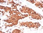 Napsin A (Lung Adenocarcinoma Marker) Recombinant Rabbit Monoclonal Antibody (NAPSA/7165R)