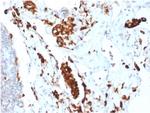 Napsin A Recombinant Rabbit Monoclonal Antibody (NAPSA, 1865R)
