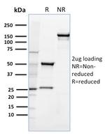 CD36 (Platelet and Microvessel Marker) Antibody in SDS-PAGE (SDS-PAGE)