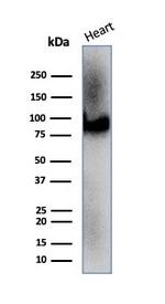 CD36 (Platelet and Microvessel Marker) Antibody in Western Blot (WB)