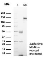 CD38 (ADP Ribosyl Cyclase I) Antibody in SDS-PAGE (SDS-PAGE)