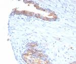 CD38 (ADP Ribosyl Cyclase I) Antibody in Immunohistochemistry (Paraffin) (IHC (P))