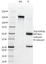 CD38 (ADP Ribosyl Cyclase I) Antibody in SDS-PAGE (SDS-PAGE)