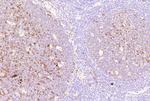 CD38 (ADP Ribosyl Cyclase I) Antibody in Immunohistochemistry (Paraffin) (IHC (P))