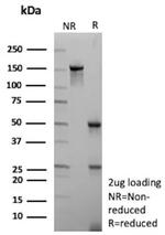 CD38 (ADP Ribosyl Cyclase I) Antibody in SDS-PAGE (SDS-PAGE)