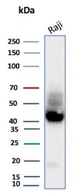 CD38 (ADP Ribosyl Cyclase I) Antibody in Western Blot (WB)