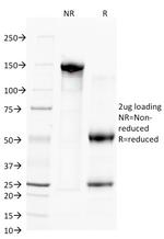 CD38 (ADP Ribosyl Cyclase 1) Antibody in SDS-PAGE (SDS-PAGE)