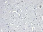 CD38 (ADP Ribosyl Cyclase I) Antibody in Immunohistochemistry (Paraffin) (IHC (P))