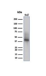CD38 (ADP Ribosyl Cyclase I) Antibody in Western Blot (WB)