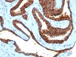 CD38 (ADP Ribosyl Cyclase I) Antibody in Immunohistochemistry (Paraffin) (IHC (P))