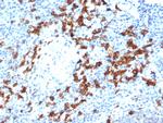 CD38 (ADP Ribosyl Cyclase I) Antibody in Immunohistochemistry (Paraffin) (IHC (P))