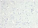CD38 (ADP Ribosyl Cyclase I) Antibody in Immunohistochemistry (Paraffin) (IHC (P))
