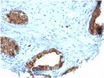CD38 (ADP Ribosyl Cyclase I) Antibody in Immunohistochemistry (Paraffin) (IHC (P))