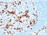 CD38 (ADP Ribosyl Cyclase I) Antibody in Immunohistochemistry (Paraffin) (IHC (P))