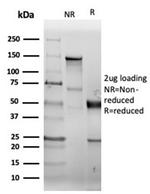 CD38 (ADP Ribosyl Cyclase I) Antibody in SDS-PAGE (SDS-PAGE)