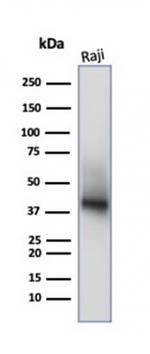 CD38 (ADP Ribosyl Cyclase I) Antibody in Western Blot (WB)