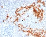CD38 (ADP Ribosyl Cyclase I) Antibody in Immunohistochemistry (Paraffin) (IHC (P))