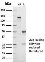 CD38 (ADP Ribosyl Cyclase I) Antibody in SDS-PAGE (SDS-PAGE)