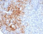 CD38 (ADP Ribosyl Cyclase I) Antibody in Immunohistochemistry (Paraffin) (IHC (P))