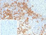 CD38 (ADP Ribosyl Cyclase I) Antibody in Immunohistochemistry (Paraffin) (IHC (P))