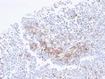 CD38 (ADP Ribosyl Cyclase I) Antibody in Immunohistochemistry (Paraffin) (IHC (P))
