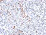 CD38 (ADP Ribosyl Cyclase I) Antibody in Immunohistochemistry (Paraffin) (IHC (P))