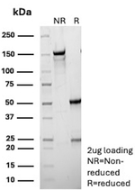 CD39/ENTPD1 (Marker of Tumor-specific T cells) Antibody in SDS-PAGE (SDS-PAGE)