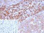 CD39 Antibody in Immunohistochemistry (Paraffin) (IHC (P))