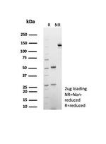 CD39 Antibody in SDS-PAGE (SDS-PAGE)