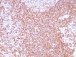 CD39 Antibody in Immunohistochemistry (Paraffin) (IHC (P))
