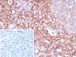 CD39 Antibody in Immunohistochemistry (Paraffin) (IHC (P))