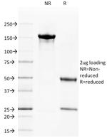 CD40/TNFRSF5/CD40L-Receptor Antibody in SDS-PAGE (SDS-PAGE)