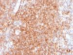 CD40/TNFRSF5/CD40L-Receptor Monoclonal Antibody (C40/2383)